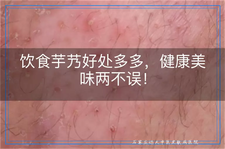 饮食芋艿好处多多，健康美味两不误！