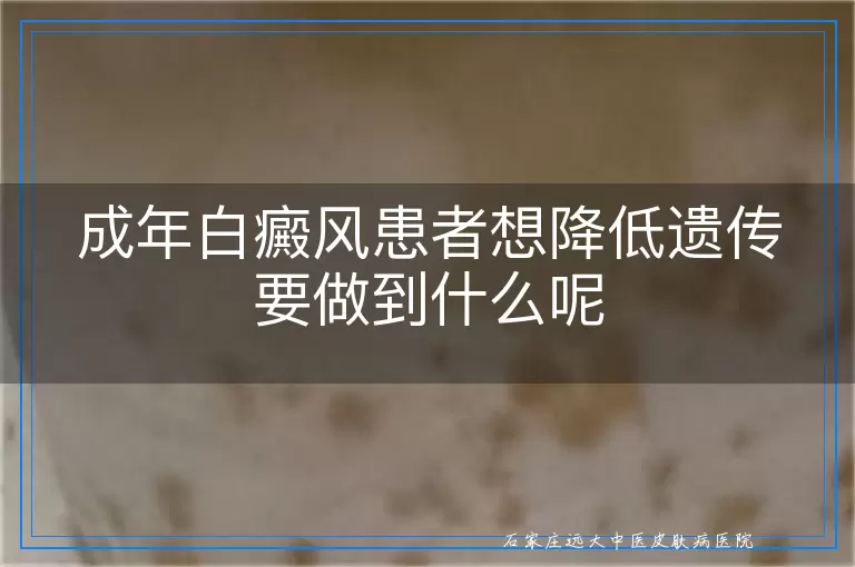 成年白癜风患者想降低遗传要做到什么呢