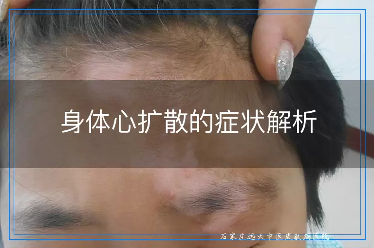 身体心扩散的症状解析