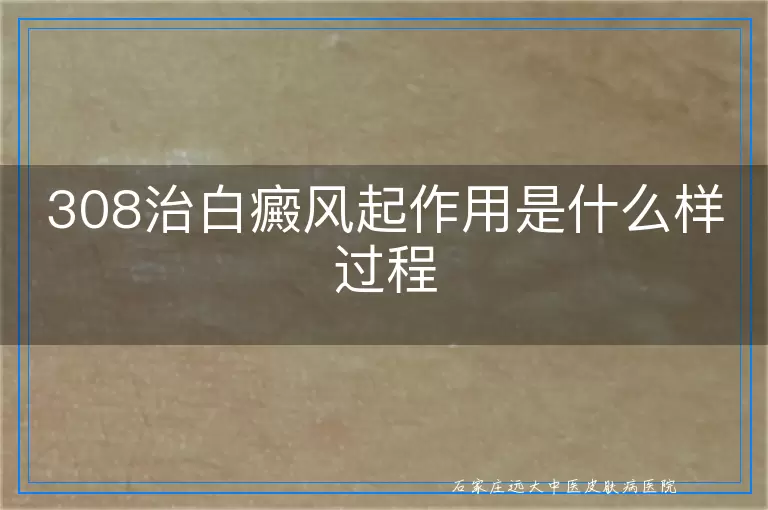 308治白癜风起作用是什么样过程