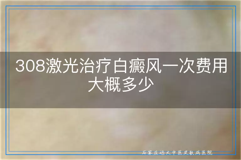 308激光治疗白癜风一次费用大概多少