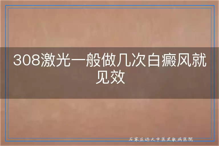 308激光一般做几次白癜风就见效