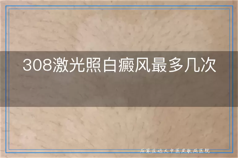 308激光照白癜风最多几次