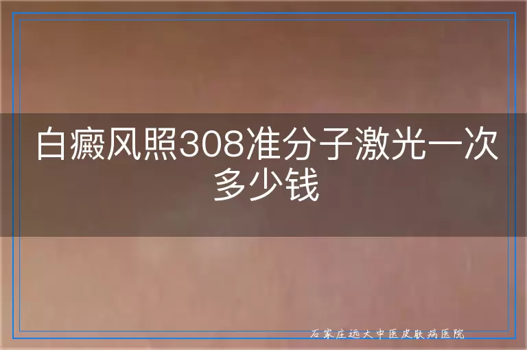 白癜风照308准分子激光一次多少钱