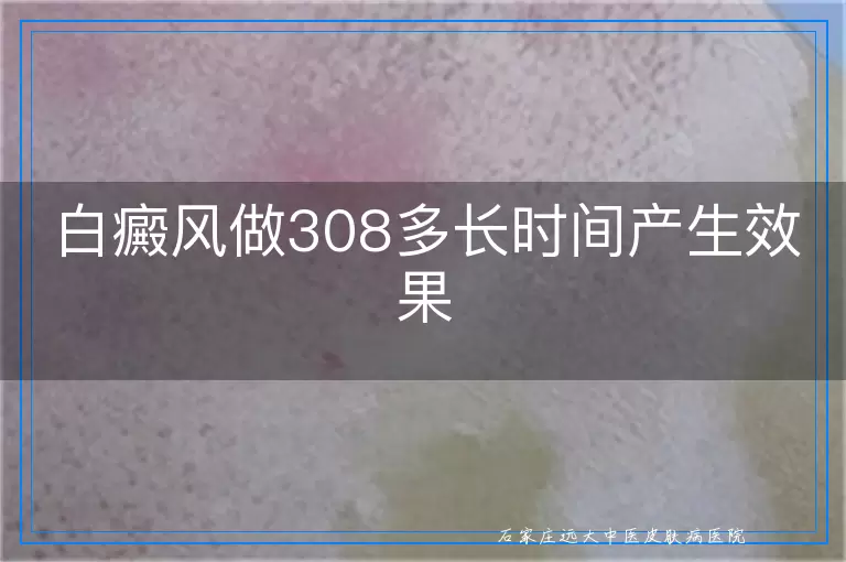 白癜风做308多长时间产生效果