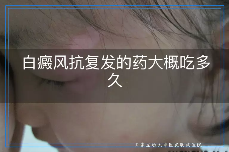 白癜风抗复发的药大概吃多久
