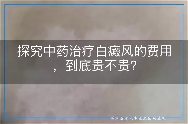 探究中药治疗白癜风的费用，到底贵不贵？