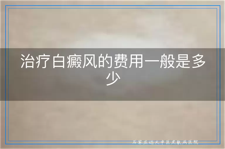 治疗白癜风的费用一般是多少
