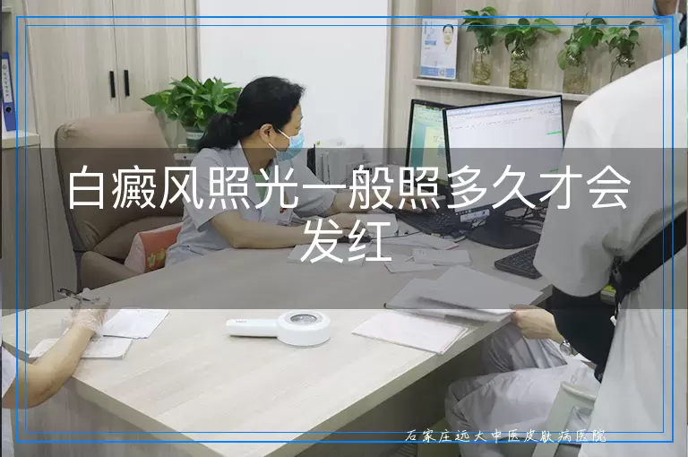 白癜风照光一般照多久才会发红