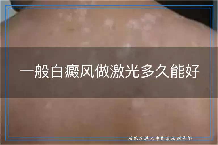 一般白癜风做激光多久能好