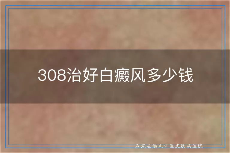 308治好白癜风多少钱