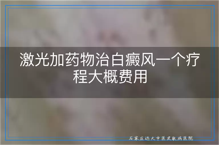 激光加药物治白癜风一个疗程大概费用