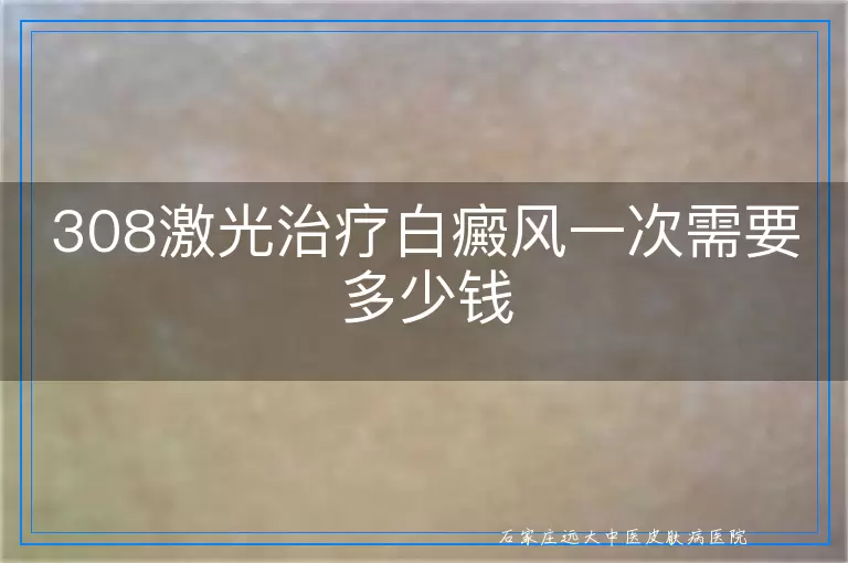 308激光治疗白癜风一次需要多少钱