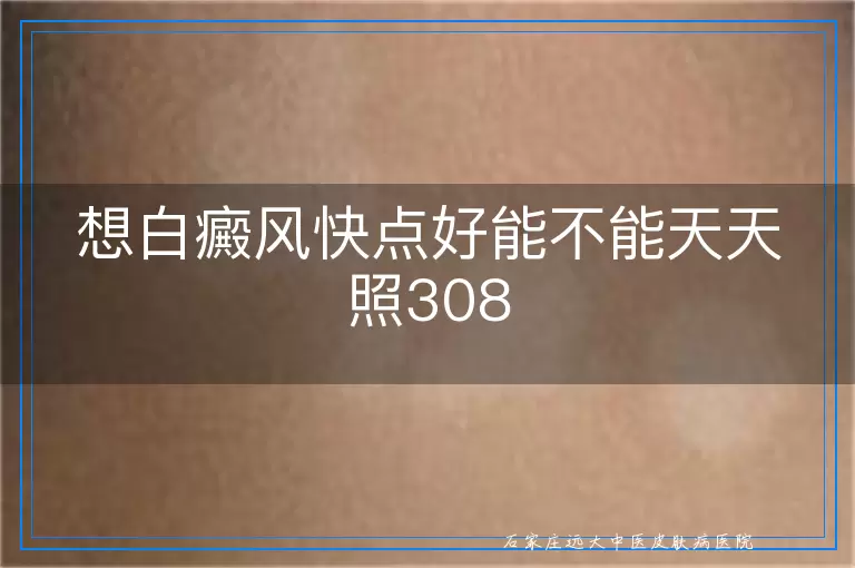想白癜风快点好能不能天天照308