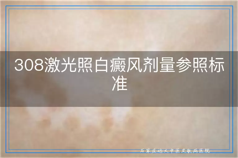 308激光照白癜风剂量参照标准