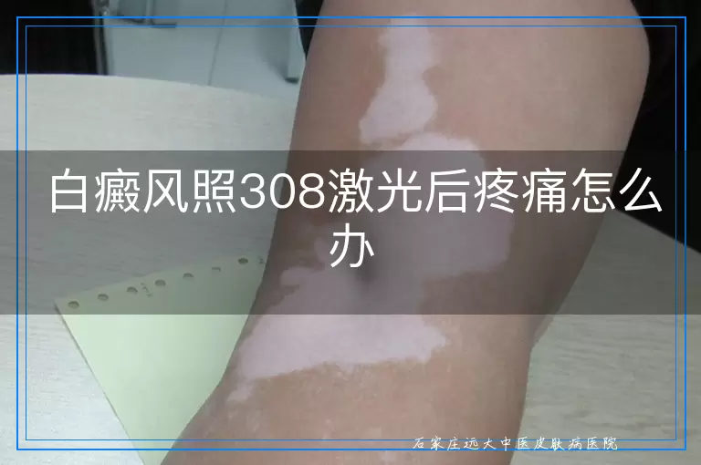白癜风照308激光后疼痛怎么办