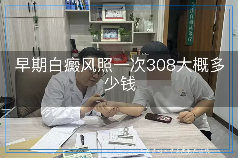 早期白癜风照一次308大概多少钱