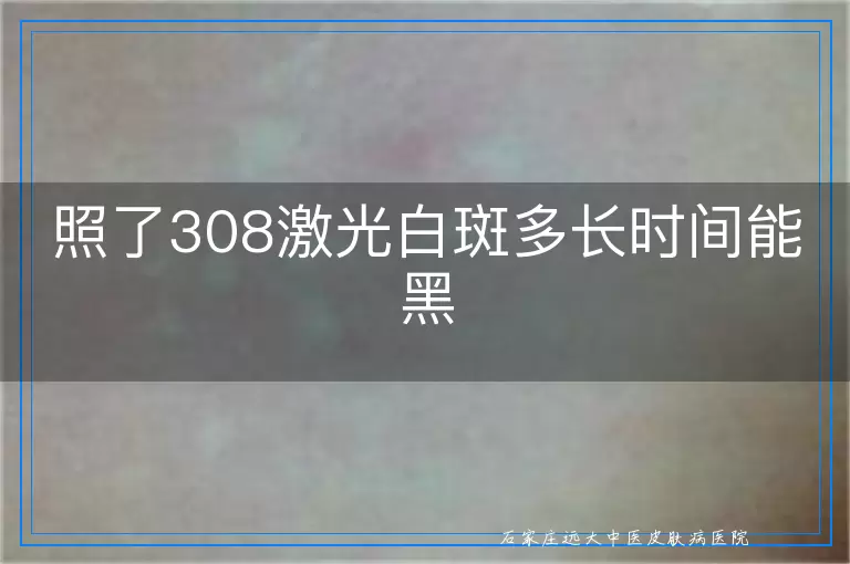 照了308激光白斑多长时间能黑