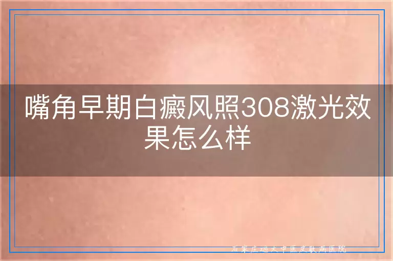 嘴角早期白癜风照308激光效果怎么样