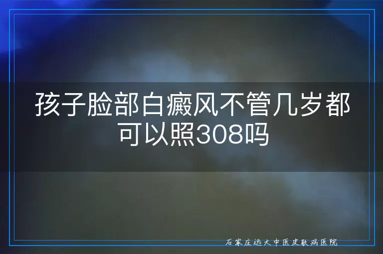孩子脸部白癜风不管几岁都可以照308吗
