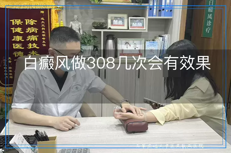 白癜风做308几次会有效果