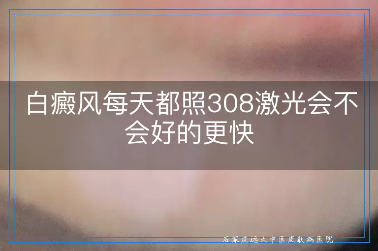 白癜风每天都照308激光会不会好的更快