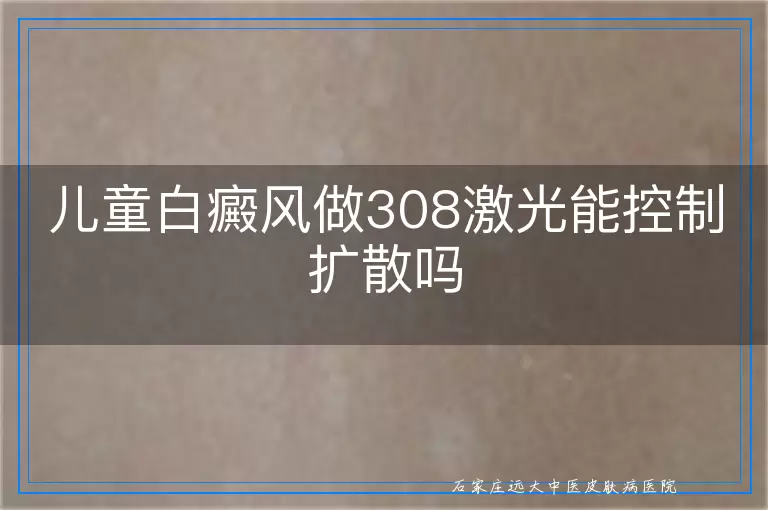儿童白癜风做308激光能控制扩散吗