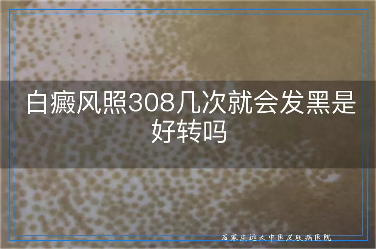 白癜风照308几次就会发黑是好转吗