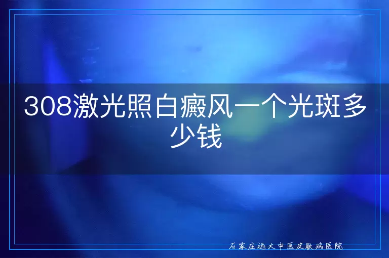 308激光照白癜风一个光斑多少钱