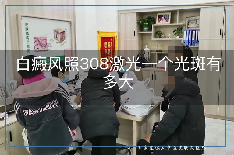 白癜风照308激光一个光斑有多大