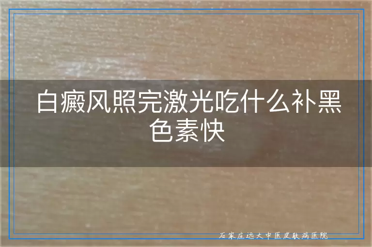 白癜风照完激光吃什么补黑色素快
