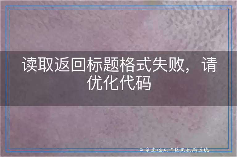 读取返回标题格式失败，请优化代码