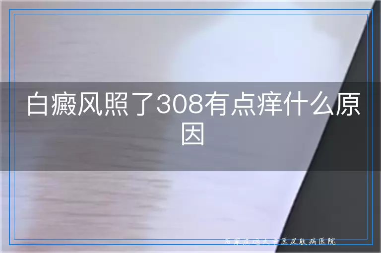 白癜风照了308有点痒什么原因