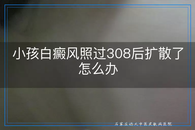 小孩白癜风照过308后扩散了怎么办