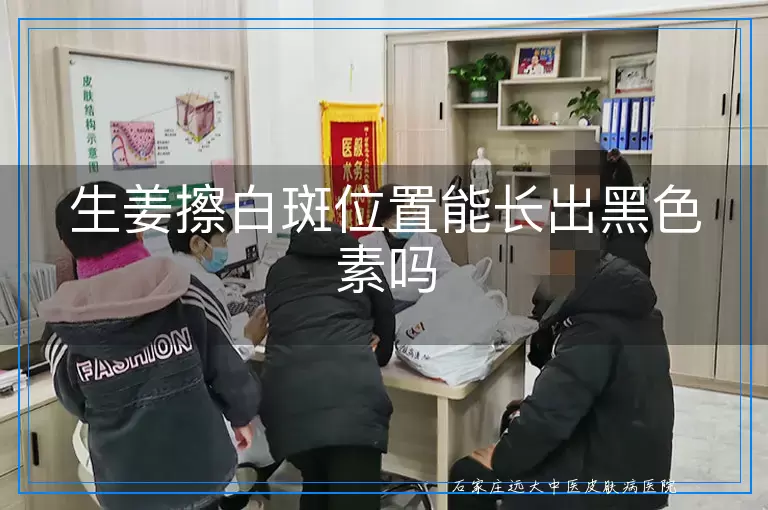 生姜擦白斑位置能长出黑色素吗