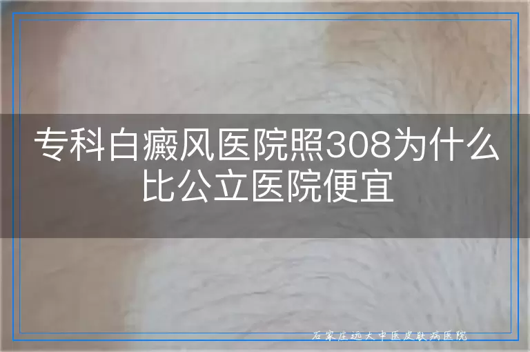 专科白癜风医院照308为什么比公立医院便宜