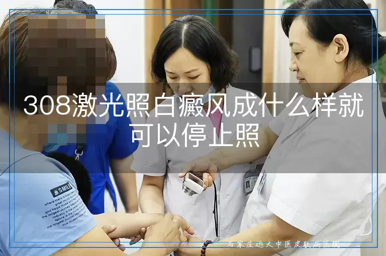 308激光照白癜风成什么样就可以停止照