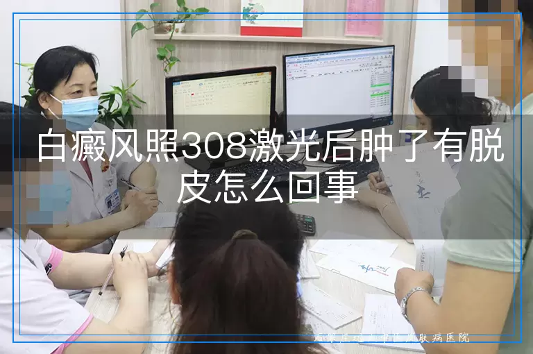 白癜风照308激光后肿了有脱皮怎么回事