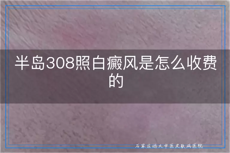半岛308照白癜风是怎么收费的