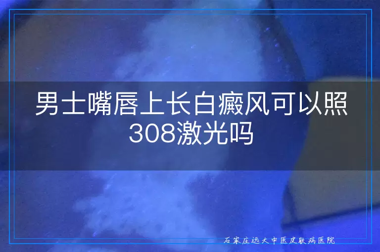 男士嘴唇上长白癜风可以照308激光吗