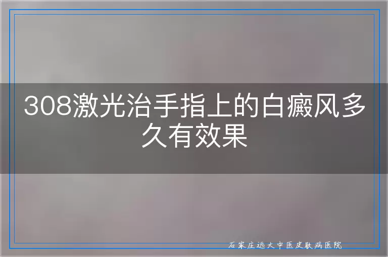 308激光治手指上的白癜风多久有效果