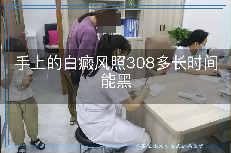 手上的白癜风照308多长时间能黑