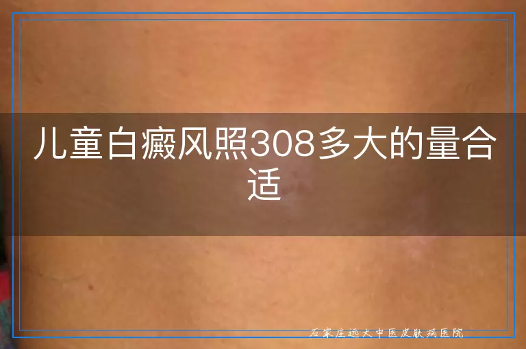 儿童白癜风照308多大的量合适