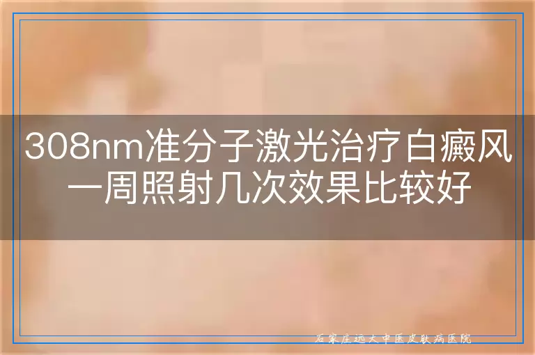 308nm准分子激光治疗白癜风一周照射几次效果比较好