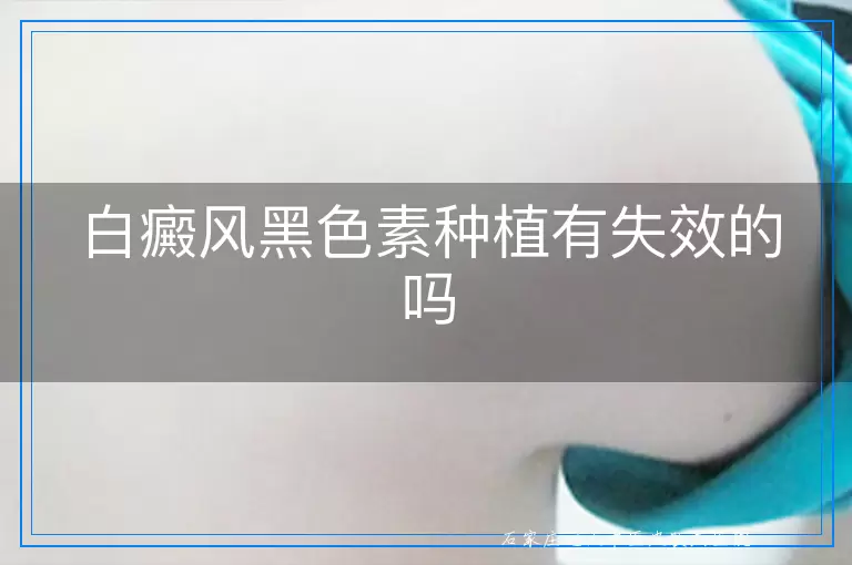 白癜风黑色素种植有失效的吗
