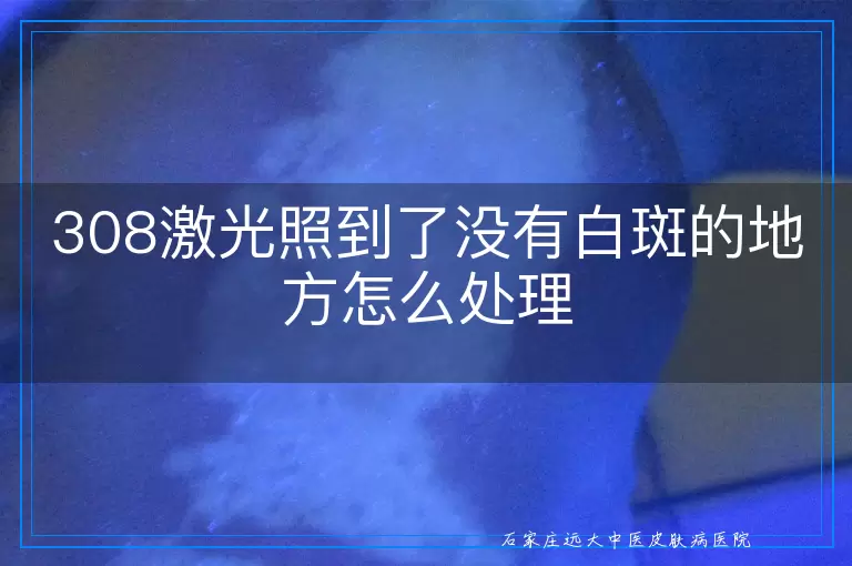 308激光照到了没有白斑的地方怎么处理