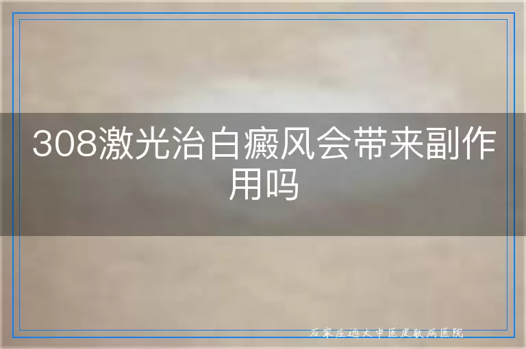 308激光治白癜风会带来副作用吗