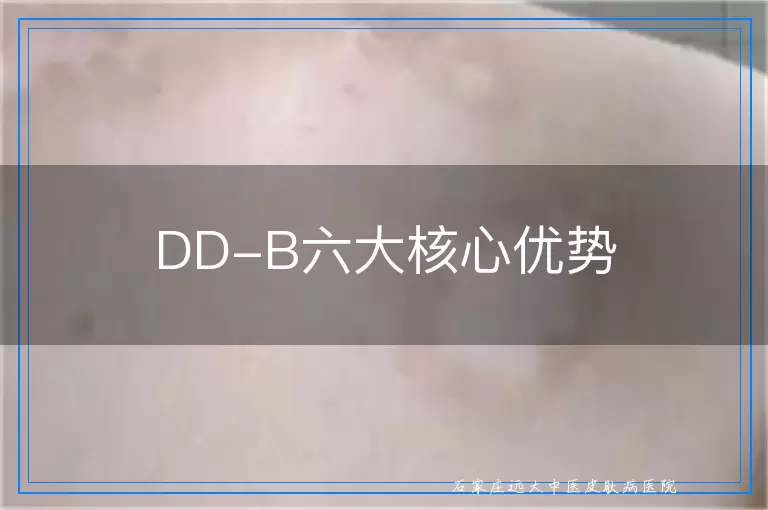 DD-B六大核心优势