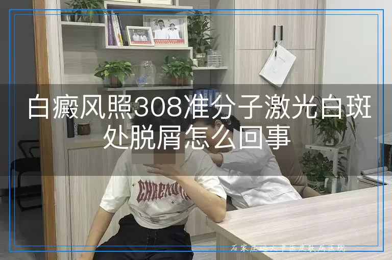 白癜风照308准分子激光白斑处脱屑怎么回事