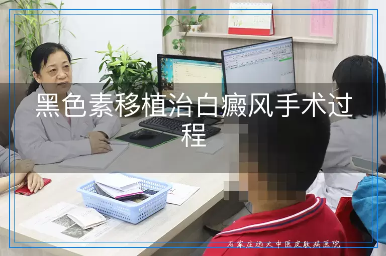 黑色素移植治白癜风手术过程